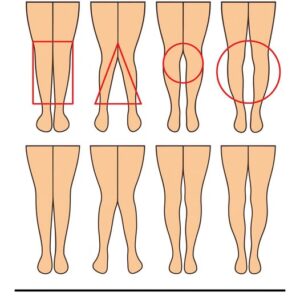 A WOMAN’S LEGS CAN TELL HOW HER IS
