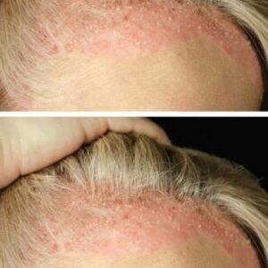 These are the consequences of showering with…See more