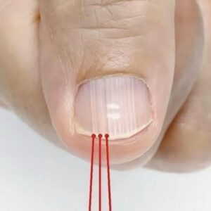 If you have these lines on your nails after 40, it is a clear sign that..