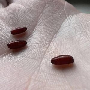 I just found this thing on my bed. It’s kind of freaking me out. What is it?…See more